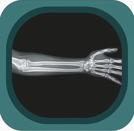 x ray  forearm anatomy icon